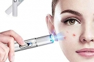 Portable-Blue-Light-Therapy-Acne-Laser-Pen-Skin-Spots-Removal-Pen